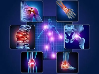 Welcome To Ayush Joint – Best Joint Pain Medicines Oil and Capsules Welcome To Ayush Joint - Best Joint Pain Medicines Oil and Capsules